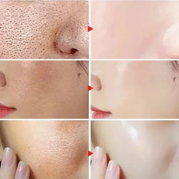 Salicylic Acid Pore Shrinking Cream Quick Elimination Large Pores Remove Blackehead Tighten Face Smooth Skin Korean Care Product - Image 3