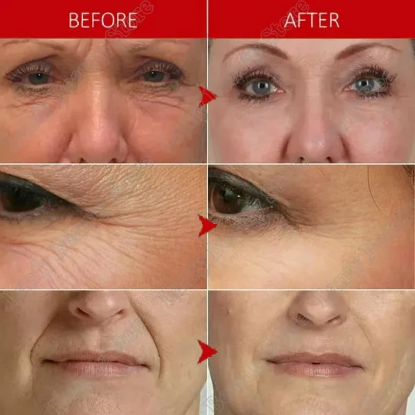 Instant Remove Wrinkle Cream Anti-Aging Fade Fine Lines Reduce Wrinkles Retinol Lifting Firming Whitening Moisturizing Face Skin - Image 2