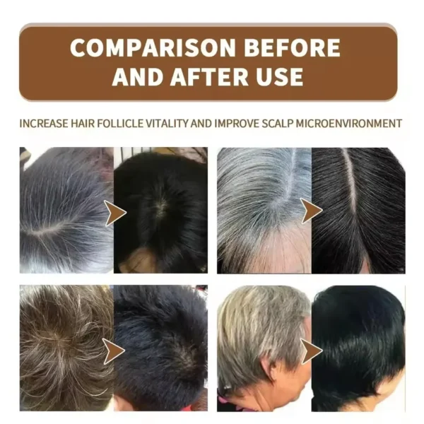 gray white hair treatment serum cover white hair to black natural color repair spray anti loss hair restore healthy hair care