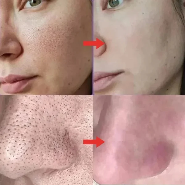 Salicylic Acid Pore Shrinking Cream Quick Elimination Large Pores Remove Blackehead Tighten Face Smooth Skin Korean Care Product - Image 2