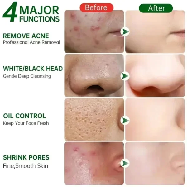 Salicylic Acid Pore Shrinking Cream Quick Elimination Large Pores Remove Blackehead Tighten Face Smooth Skin Korean Care Product - Image 4
